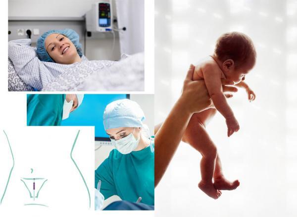 gyn-cs-header Verhütung nach Kaiserschnitt